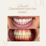 Safira Odontologia | Clareamento Dental | Dentista em Goiânia