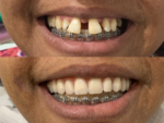🦷 OdontoDias – Dentista em Mogi Mirim