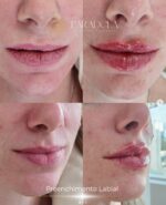 Dra Simone Paradela Clínica de Estética, Drenagem, Botox, Harmonização Facial em São Paulo