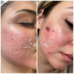 CENTRO DE ESTÉTICA LAPIDATE – NUCIA PIRES